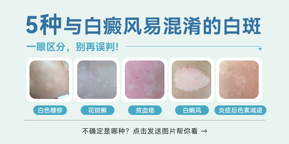 不同白斑类型的图片参考