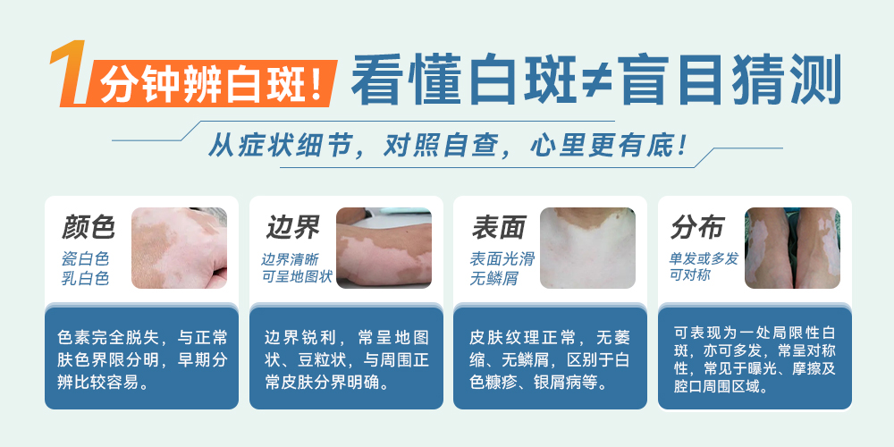 皮肤镜与伍德灯诊断示意图